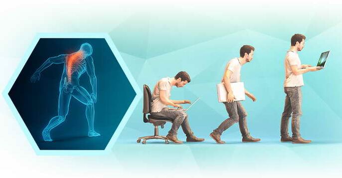 bilgisayarda çalışırken kötü duruş ve torasik osteokondroz