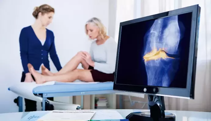 bir kadında eklem artrozu