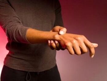 Artrit nedeniyle parmak eklemlerinde şiddetli ağrı ve hareket zorluğu