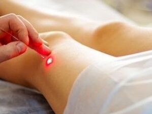 Diz ekleminin bir lazerle artroz tedavisi